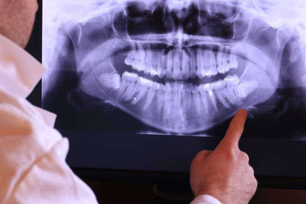 Best Broken Tooth Emergency  in Weldon, CA